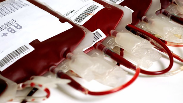 transfuzija-krvi.jpg