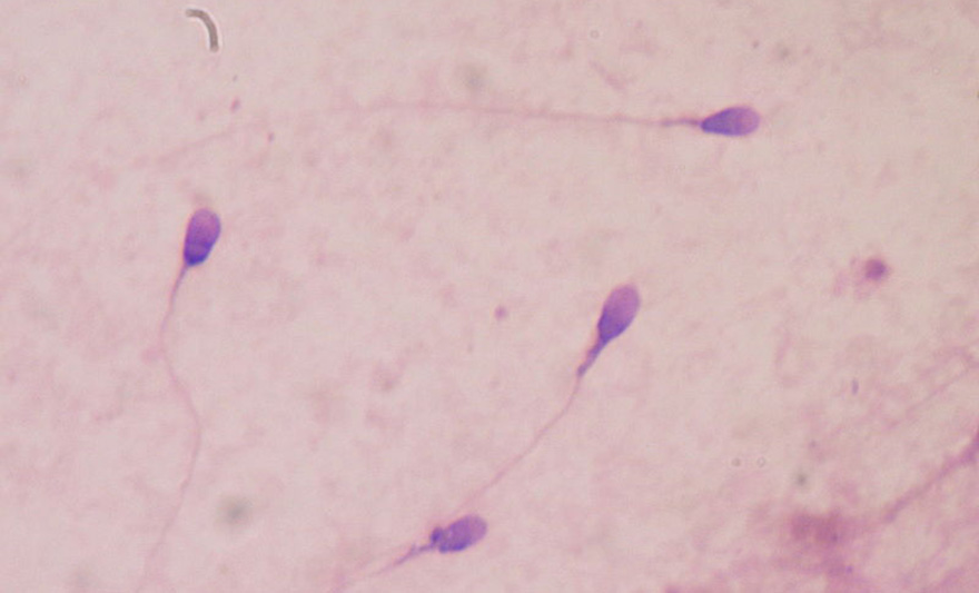 spermatozoidi-wikimedia.jpg