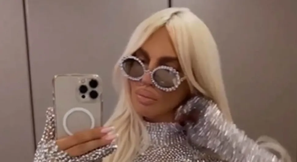 Jelena Karleuša ima zdravstveni problem - progovorila je o njemu