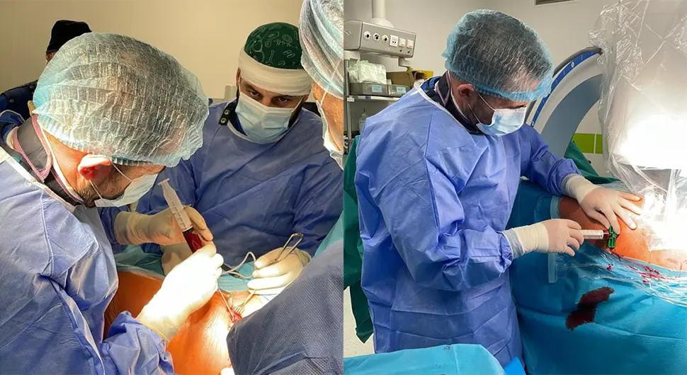 Na UKC-u Srpske izvedena operacija liječenja avaskularne nekroze glave butne kosti