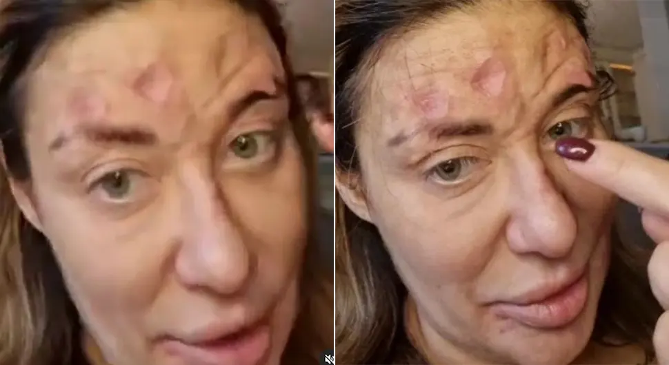 Poznati hirurg objašnjava šta bi mogao biti problem s licem Ane Nikolić