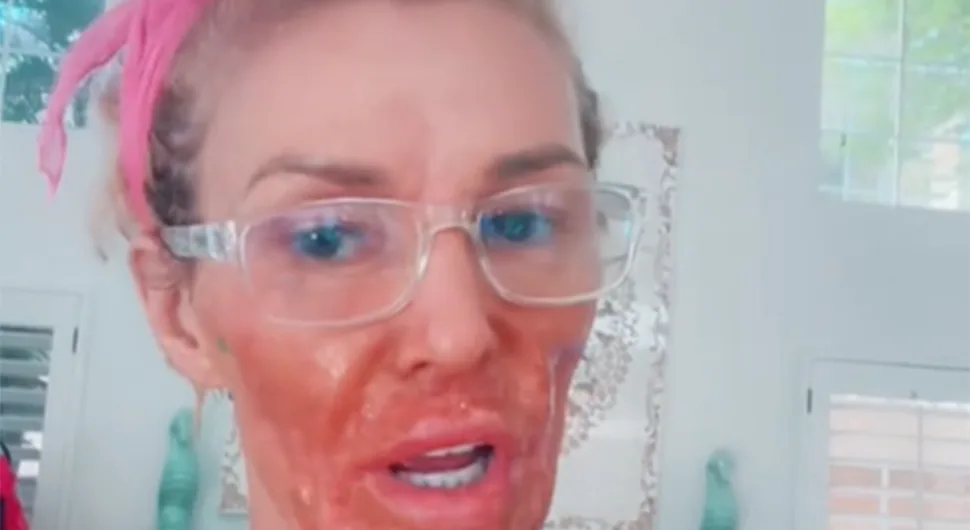 Influenserka objavila jeziv snimak: 'Paraziti mi skaču po licu'